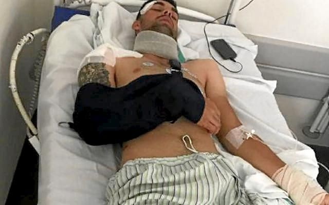 Un ciclista sub 23, atropellado por un camión que se dio a la fuga