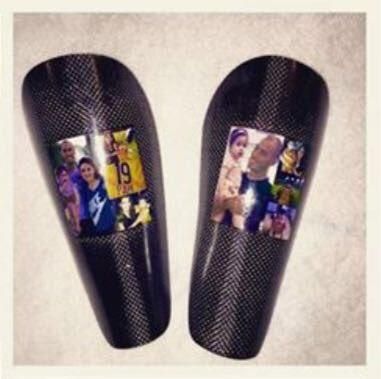 Las explicaciones de Pizarro sobre sus espinilleras