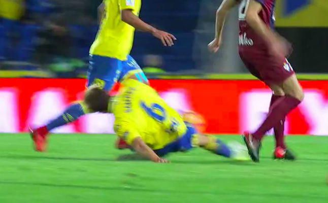 Posible lesión de tibia y peroné de Samper