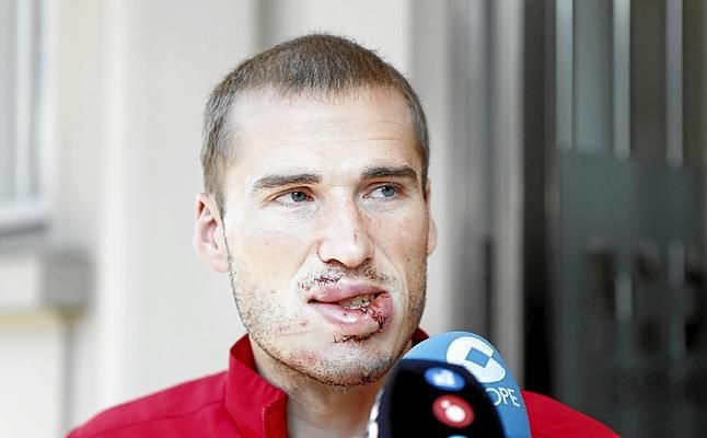 A Bergantiños le han tenido que reconstruir el labio