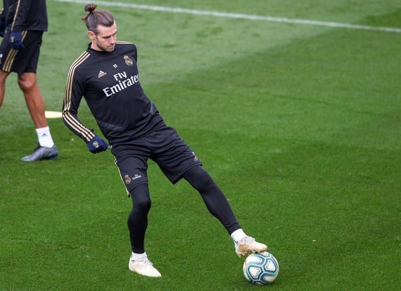 Bale, nuevo parón por un edema