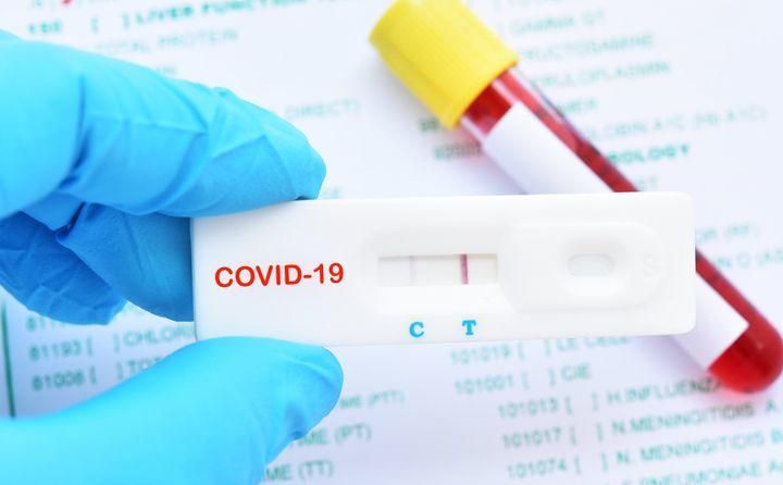 Seis positivos por coronavirus en Dos Hermanas (Sevilla) en las últimas 24 horas