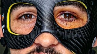Diego López y su nueva máscara de ninja: los plazos para su vuelta con el Valencia