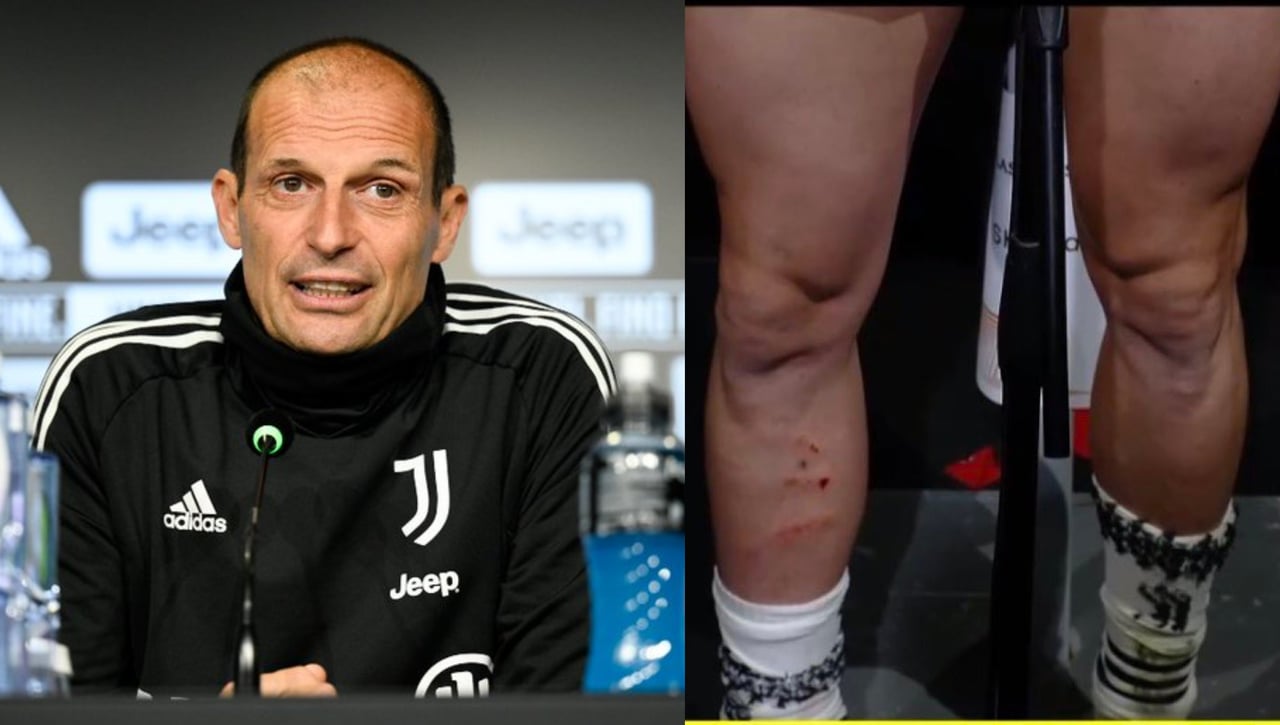 Allegri confirma que Rabiot está para jugar