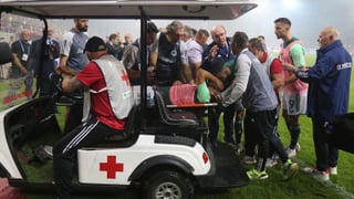 Preocupante parte médico del ex bético Juankar tras explotarle un petardo a su lado