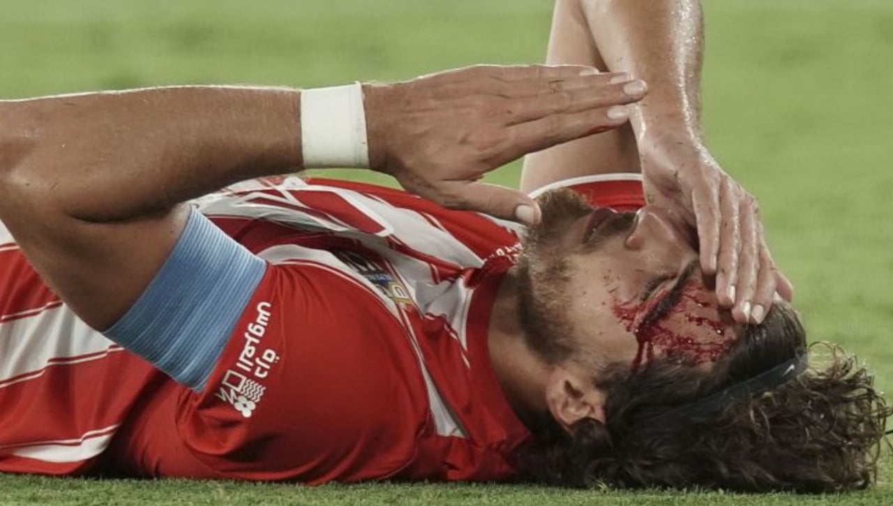 Sangre, algo de sudor e hipotéticas lágrimas en el Almería