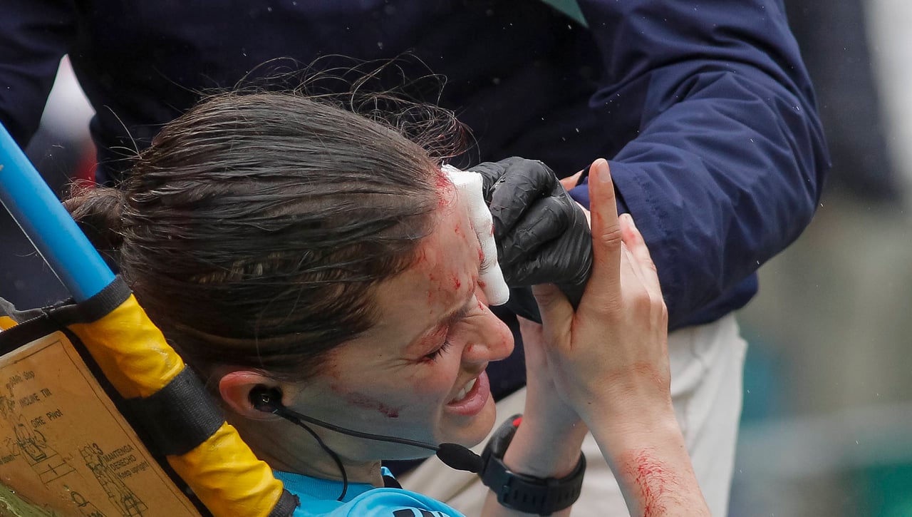 Los daños colaterales de la lesión de Guadalupe Porras Ayuso
