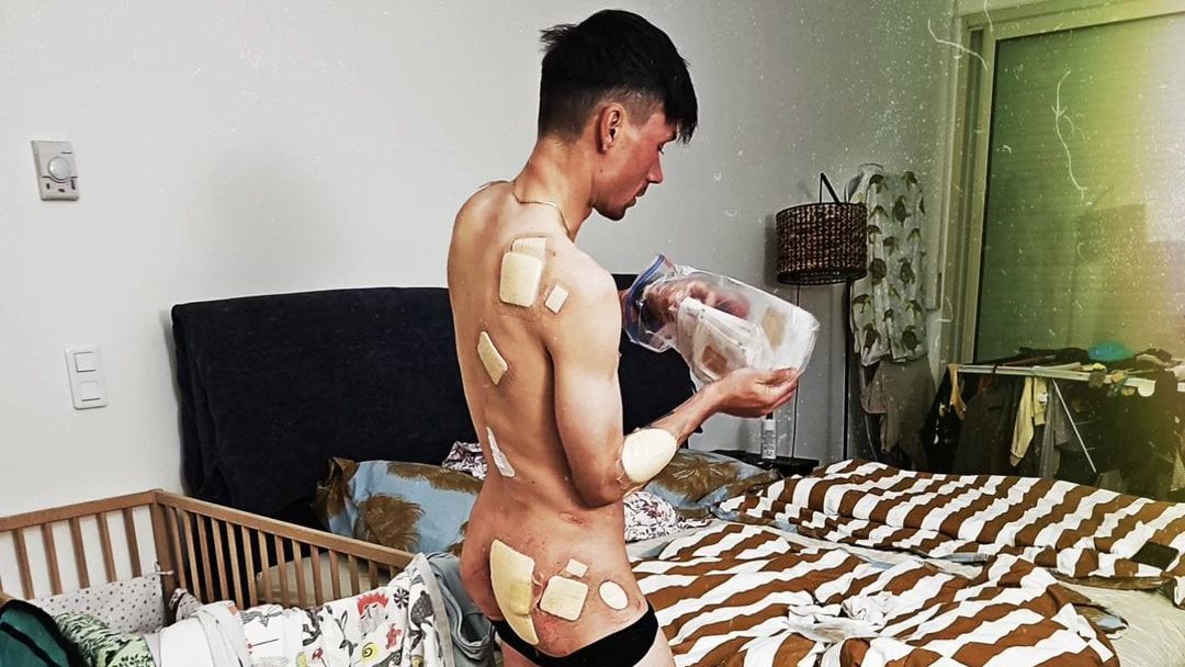 Roglic muestra los efectos de su caída