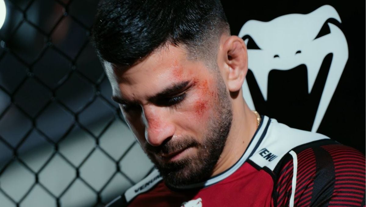 Varias voces relegan a Topuria en su salto al peso Ligero