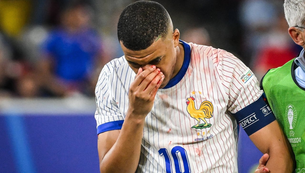 Alarma por la lesión de Mbappé: tiene que ser operado