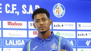 Las opciones de Choco Lozano