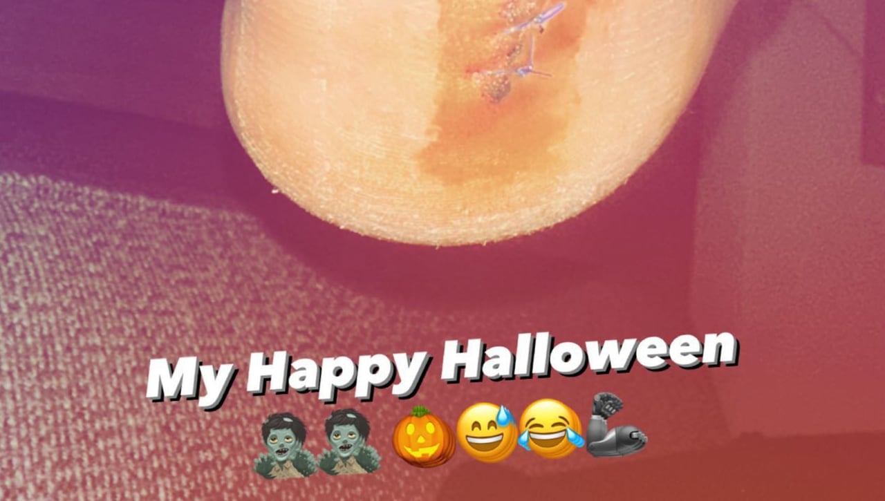 La escalofriante cicatriz de Bartra: el triste Halloween de un central al que aún se busca recambio