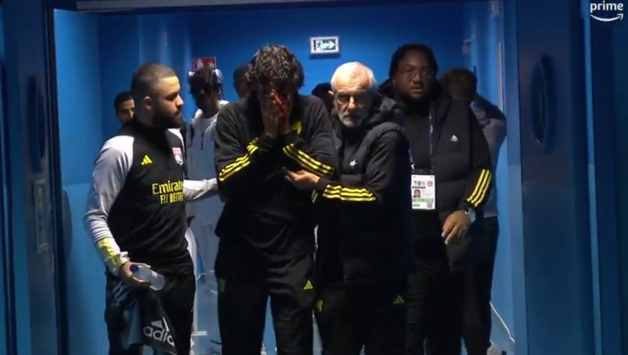Así quedó el rostro ensangrentado de Fabio Grosso, entrenador del Lyon, tras la pedrada de los radicales del Marsella
