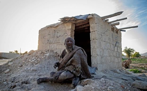 Fallece el 'hombre más guarro del mundo' después de ducharse por primera vez en más de medio siglo