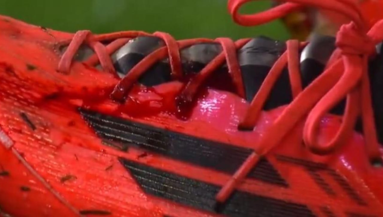 La bota de Gayà hizo saltar las alarmas