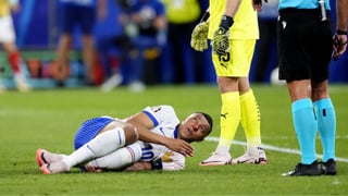 Deschamps confirma las alarmas por la nariz de Mbappé y su posible ausencia en la Eurocopa