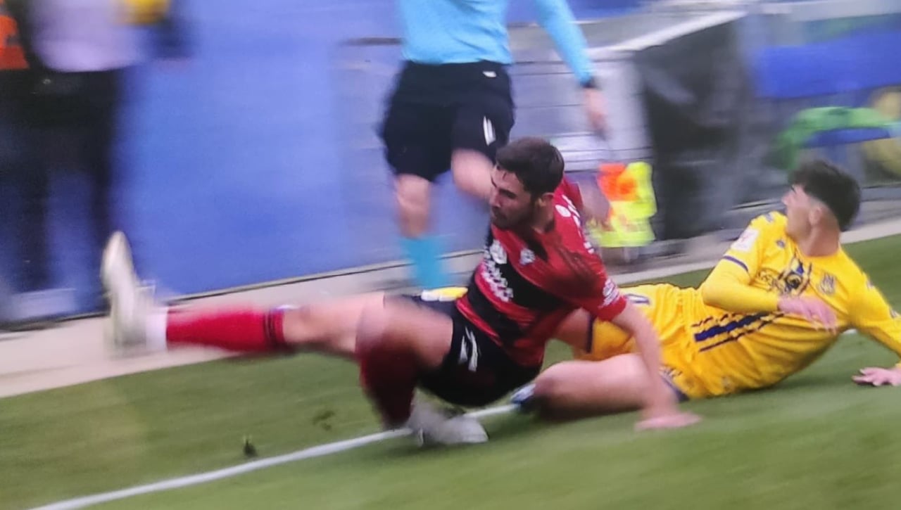 La escalofriante lesión de un cedido del Athletic