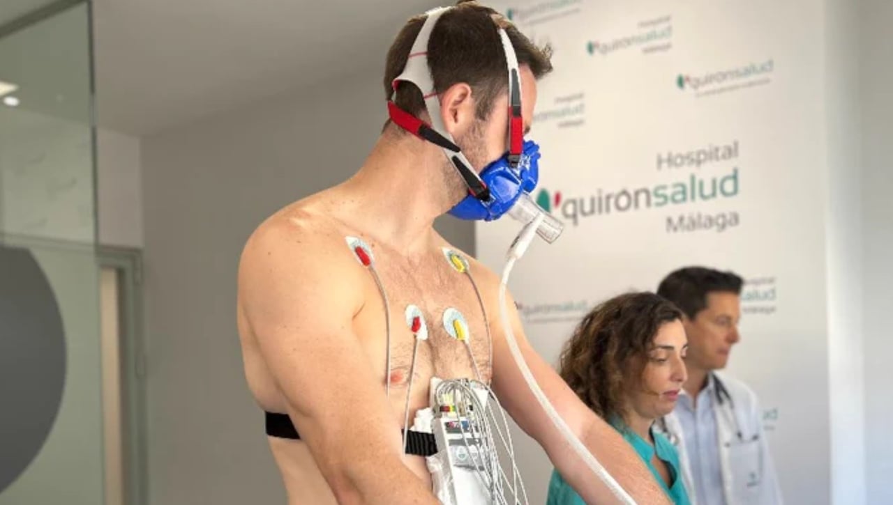 El Unicaja empieza con bajas importantes